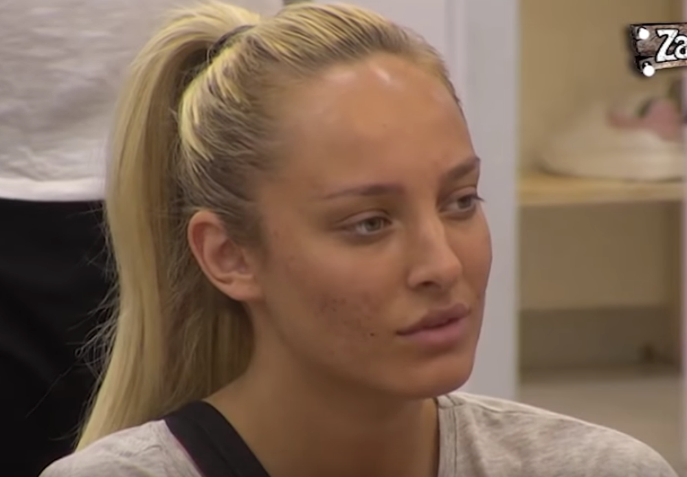 Luna UGRADILA SILIKON U ZADNJICU?! Svi šokirani nakon što je ONA priznala!