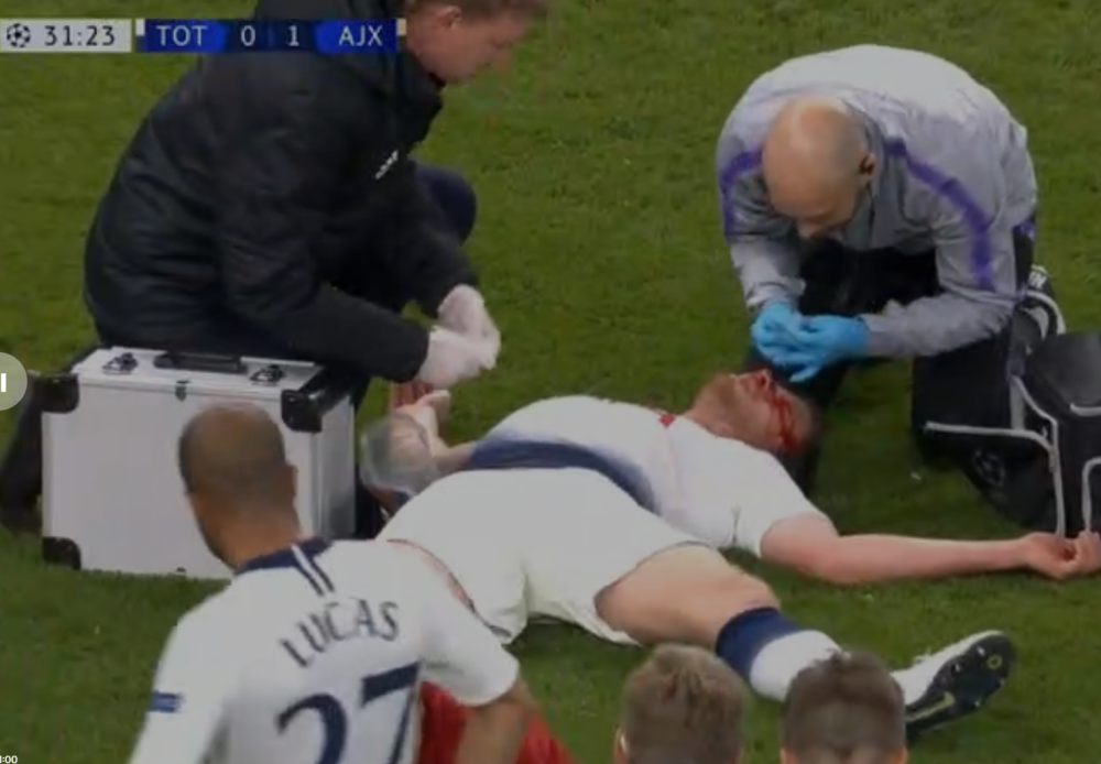 Lekari traže promenu pravila u fudbalu posle stravičnih scena Vertongena!