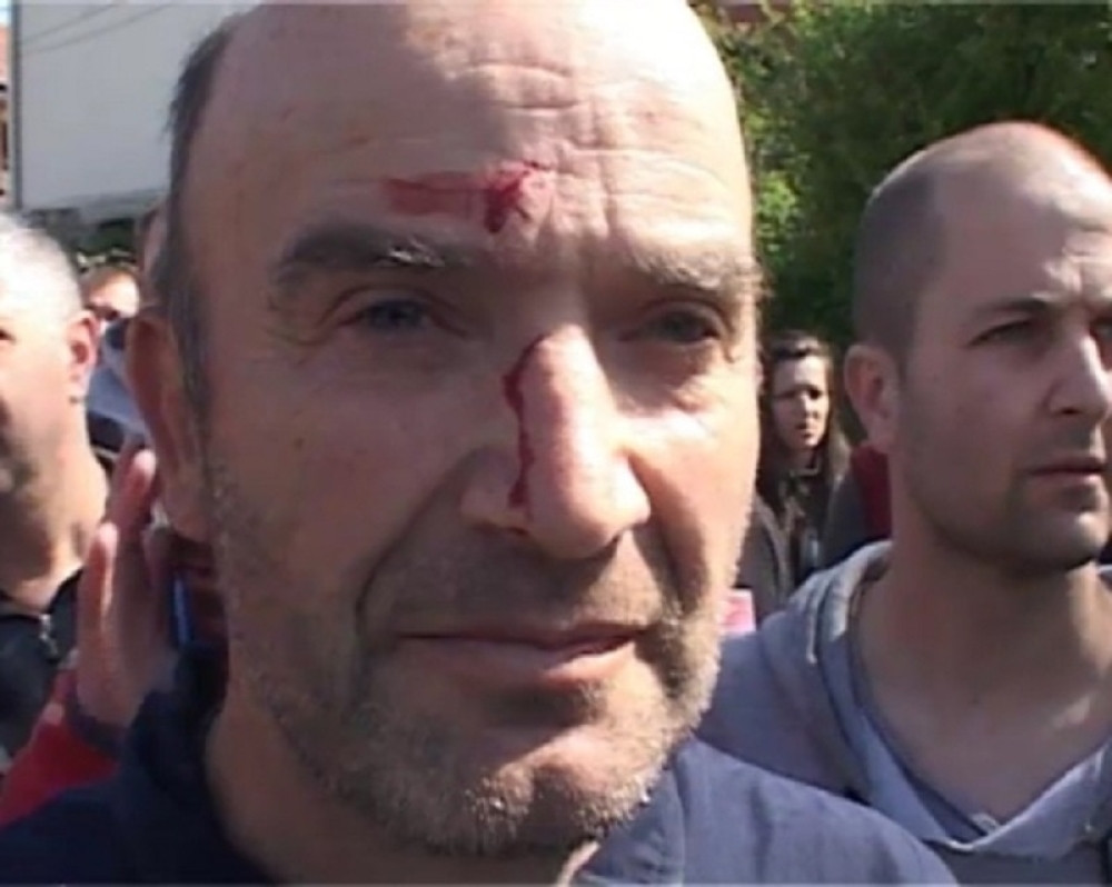 ROSU divljački napali Srbe na Kosovu! Desetine povređenih!