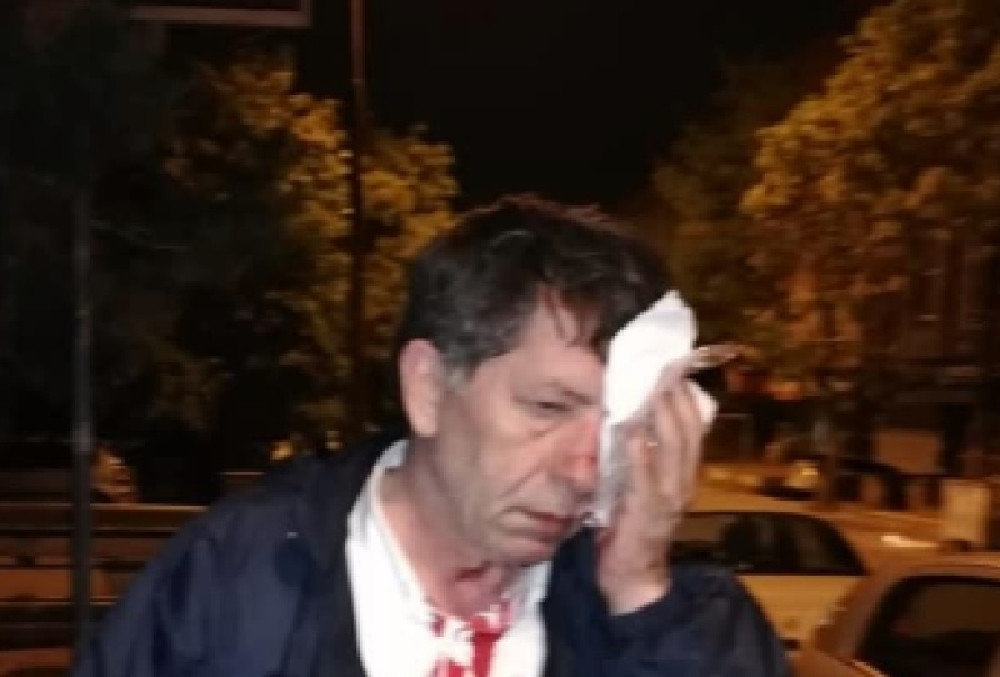 Prebijen novinar koji je pisao o izborima u Turskoj! Udarali palicama, bilo ih šestorica (FOTO, VIDEO)