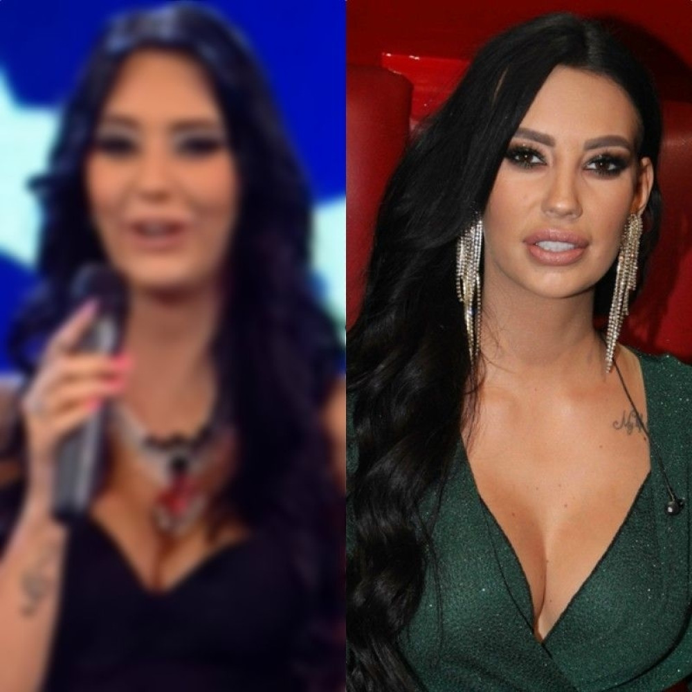 Katarina Grujić nije žalila pare za plastičara, a evo koliko se promenila od 2012. godine! (FOTO)