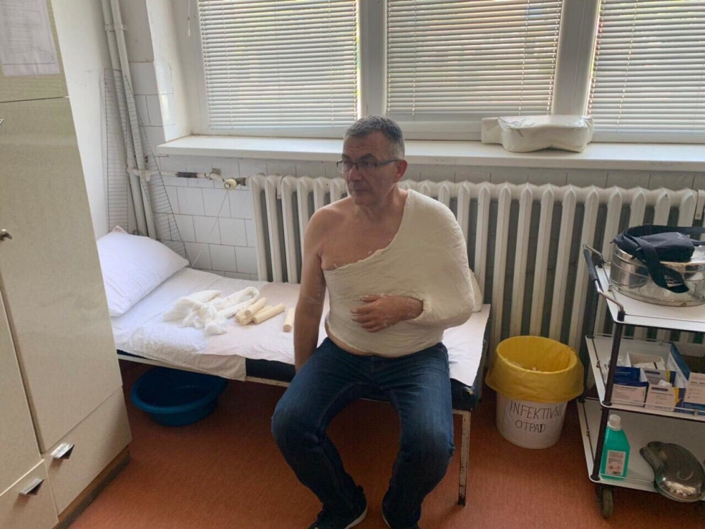 Odbornik SNS-a završio u gipsu!