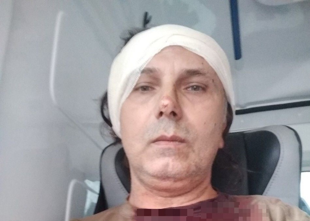 EKSKLUZIVNE SLIKE pretučenog Srboljuba, majica mu NATOPLJENA KRVLJU! (UZNEMIRUJUĆ FOTO)