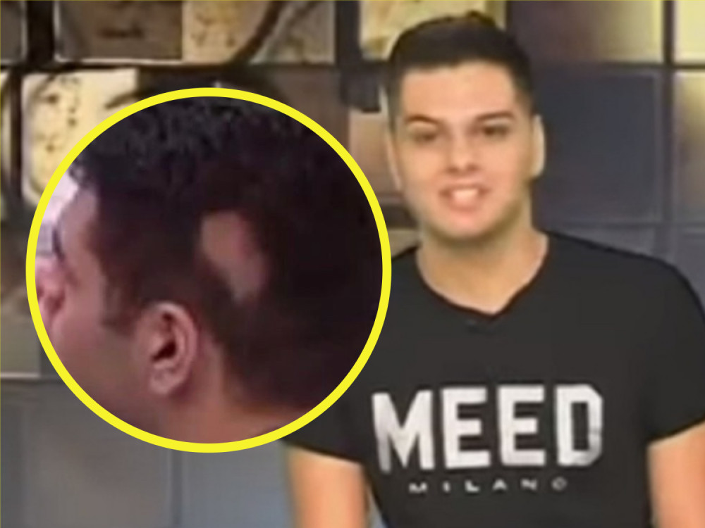 Đogani je imao ogromne pečate na glavi i gubio kosu! Sada je postavio novu fotku, svi su zinuli!