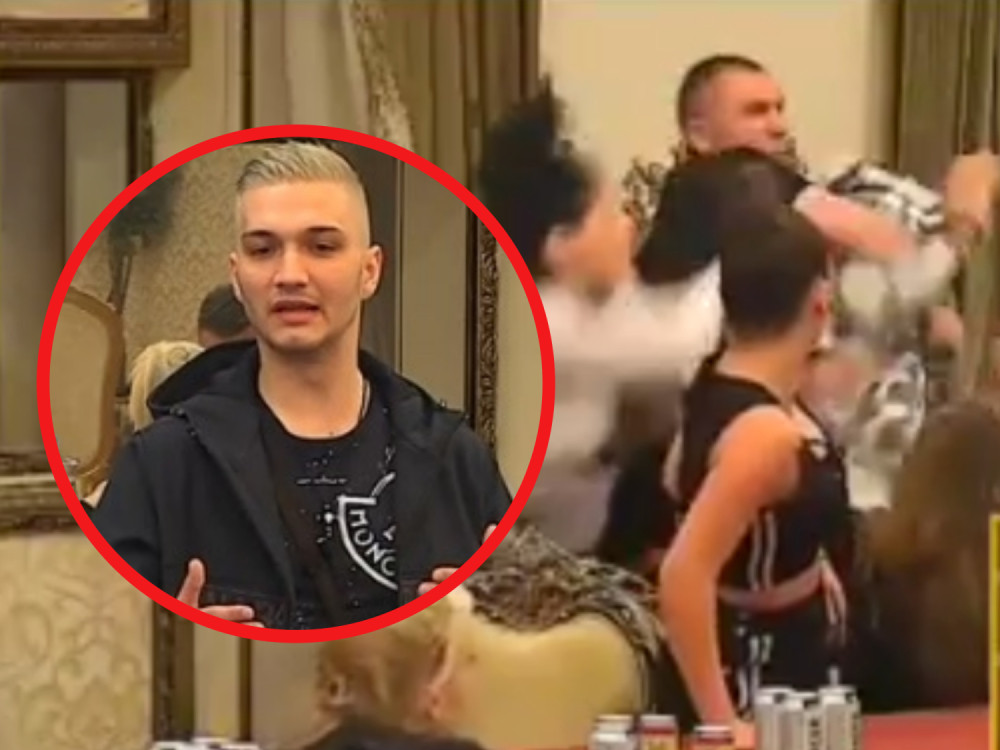 Dario nakon tuče hitno završio kod lekara?! Rasečena mu usna, modrice ispod oka, evo kako izgleda! (FOTO)