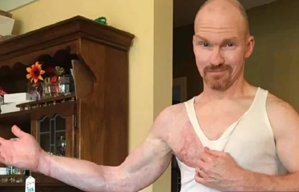 Primetio je malu izbočinu na ruci, a samo nekoliko sati kasnije BORIO SE SA SMRĆU!