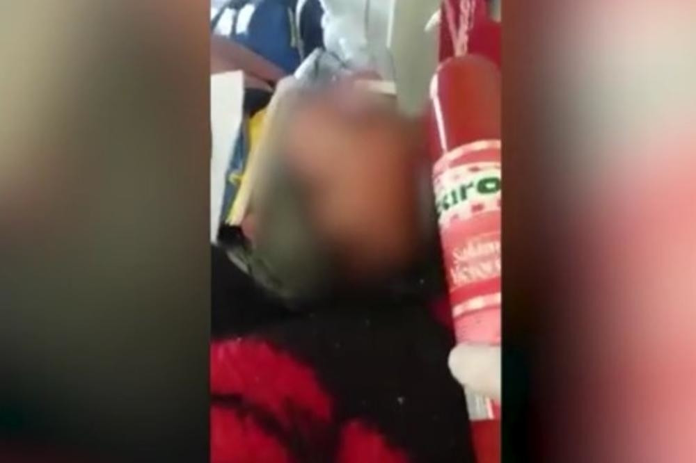 Lekar izvadio SALAMU, pa počeo da udara pacijenta bez svesti po glavi! (VIDEO)