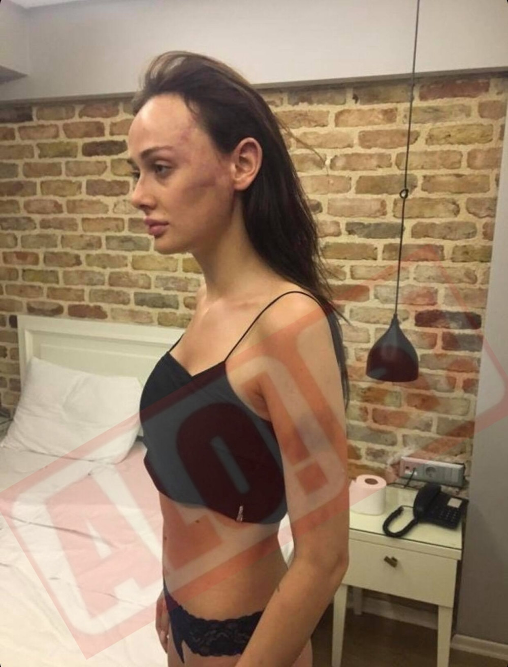 Monstrum preti SMRĆU pretučenoj manekenki i njenim roditeljima! Čagri i dalje NA SLOBODI, hvali se da je POTPLATIO POLICIJU! (FOTO)