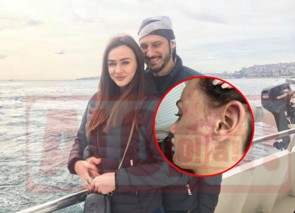 Tanja koju je zverski pretukao prestravljena! Objavio fotografiju koja je potvrdila njene crne slutnje