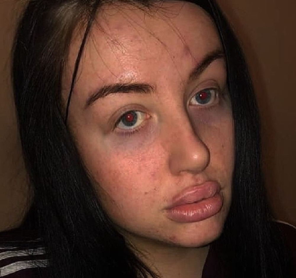 Bila je mlada, jedra, doterana... Kada joj je rođak rekao OVO, skinula je 60 kg i završila u bolnici (ŠOK FOTO)