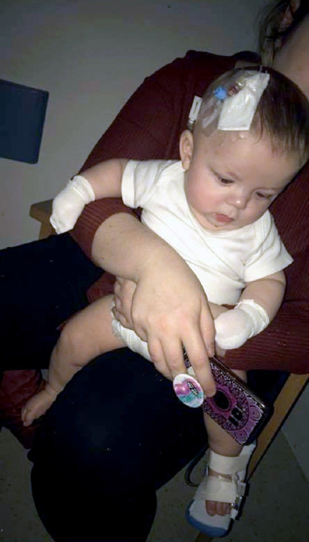 Beba dobila bolest koja se prenosi pljuvačkom, počela borba za život! Ne dozvolite da se OVO desi vašem detetu (FOTO)