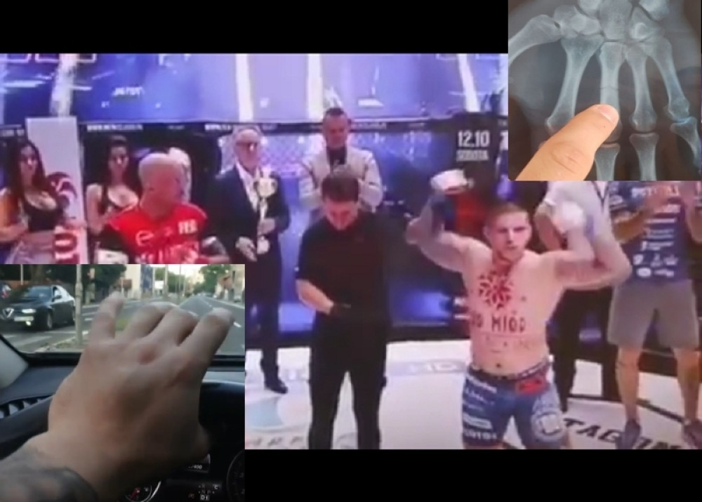 Srbin pobedio uprkos teškoj povredi: "Nisam mu**nja, debilno je što sam ovo uradio" (FOTO + VIDEO)