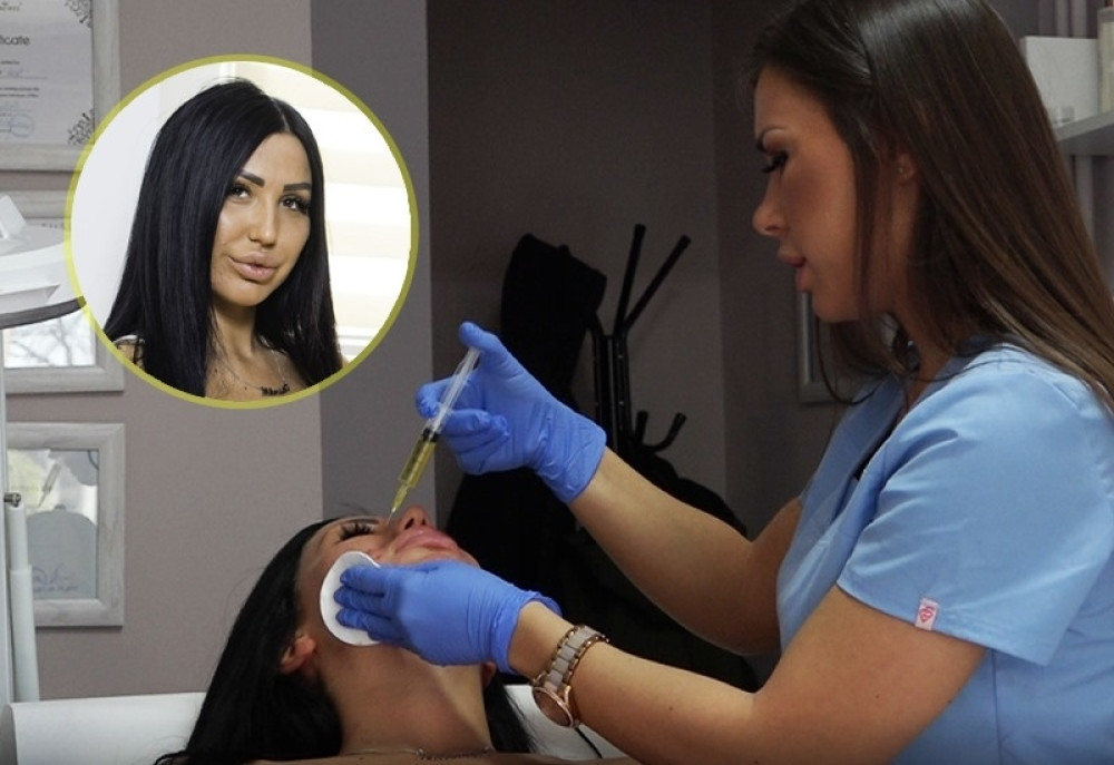 Tijana Ajfon prvi put pokazala lice bez šminke, pa se podvrgla još jednoj intervenciji! (VIDEO)