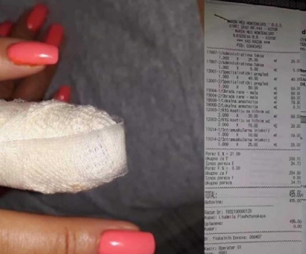Devojka povredila prst na letovanju. Račun iz kotorske bolnice peče oči: Zavoj skuplji nego celo letovanje! (FOTO)
