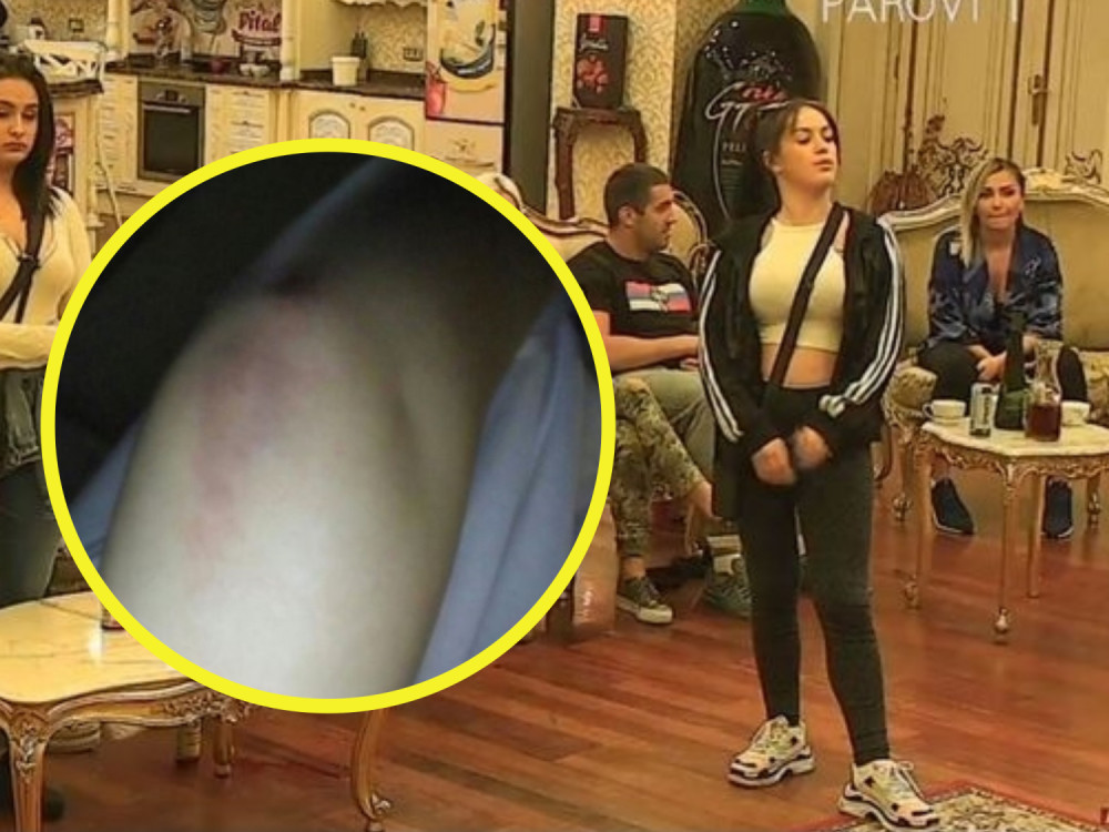 Učesnica "Parova" doživela stravičnu saobraćajnu nesreću! Ispala iz kola, izgubila svest i završila u bolnici!