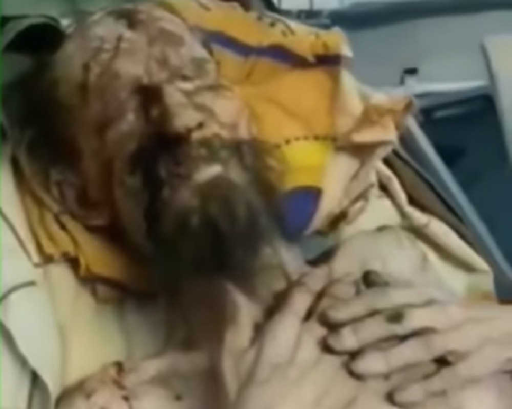 Svi su videli rane Aleksandra koga je oteo medved i slomio mu kičmu. Sada je otkrivena laž u koju je svet verovao (FOTO, VIDEO)