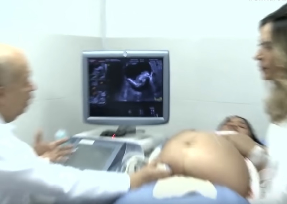Lekar se zaprepastio na ultrazvuku: Buduća majka nije htela da poveruje, morali smo da je porodimo (VIDEO)