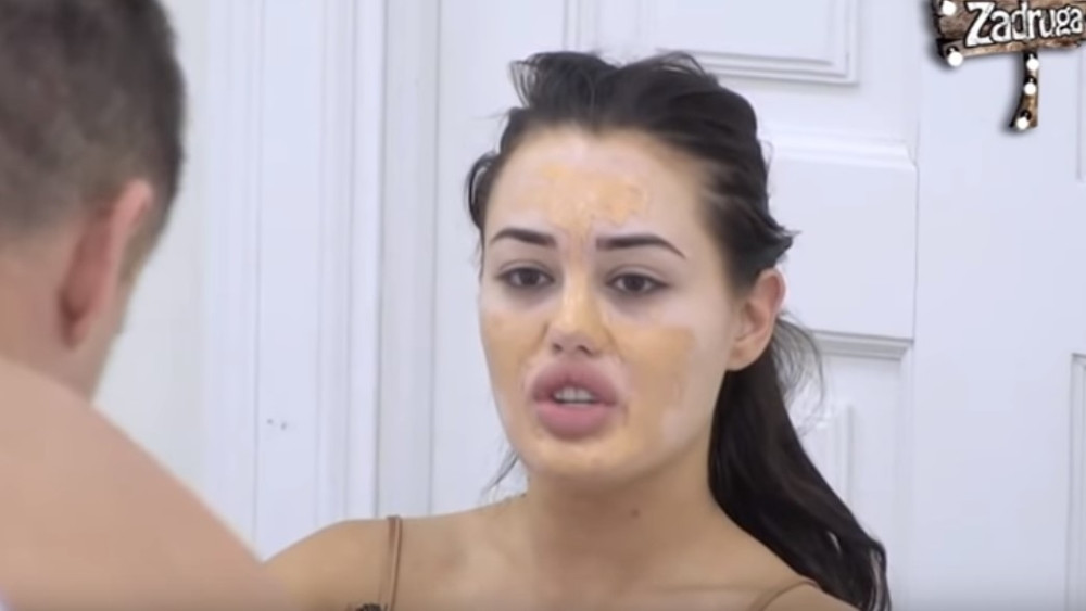 Uživo u programu otkriveno ko je FINANSIRAO sve operacije Ane Korać! Samo je spustila glavu...