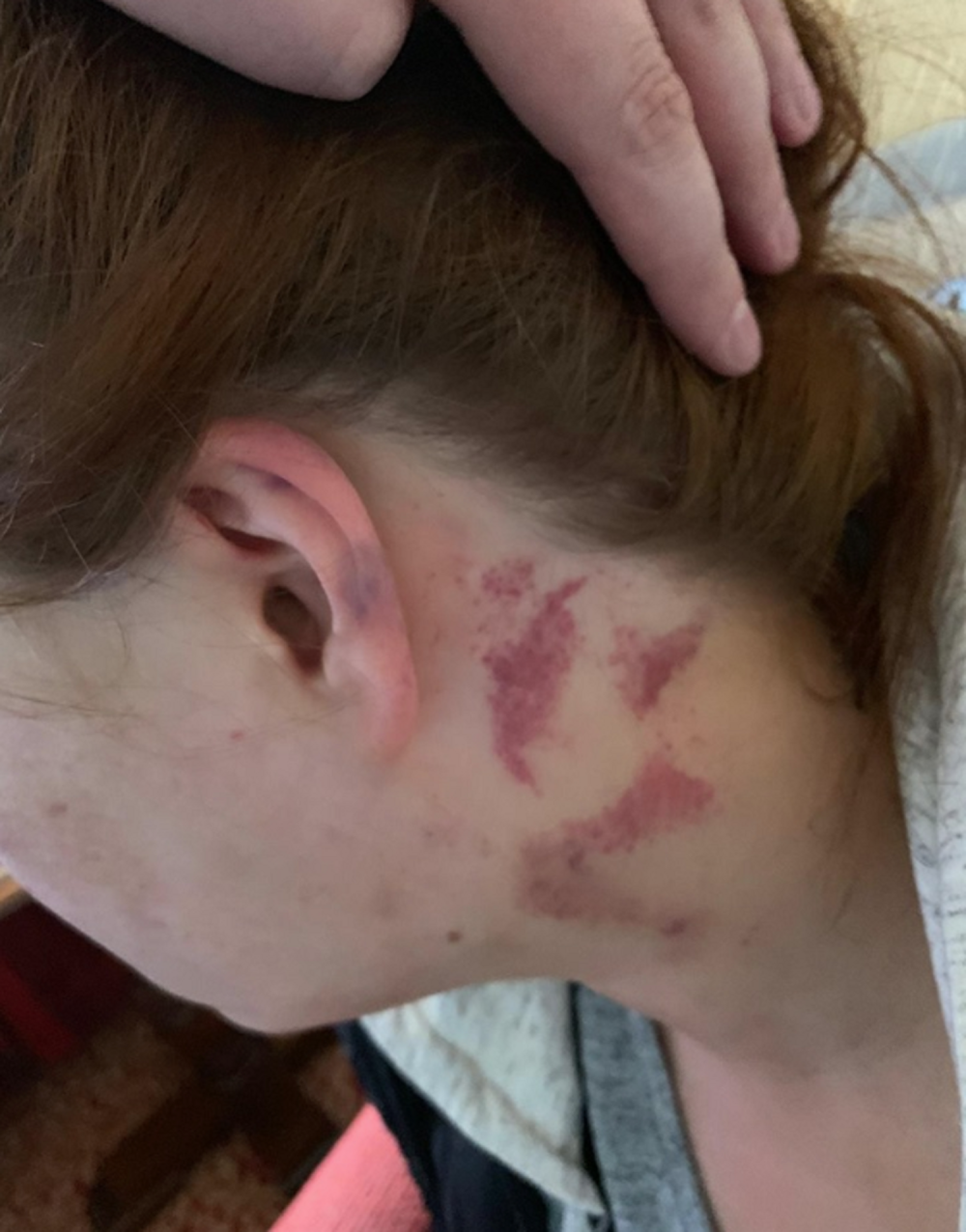 Muž uništio LEPOTICU od batina! Poslala je snažnu poruku nad kojom će se zamisliti svaka žena! (UZNEMIRUJUĆI FOTO)