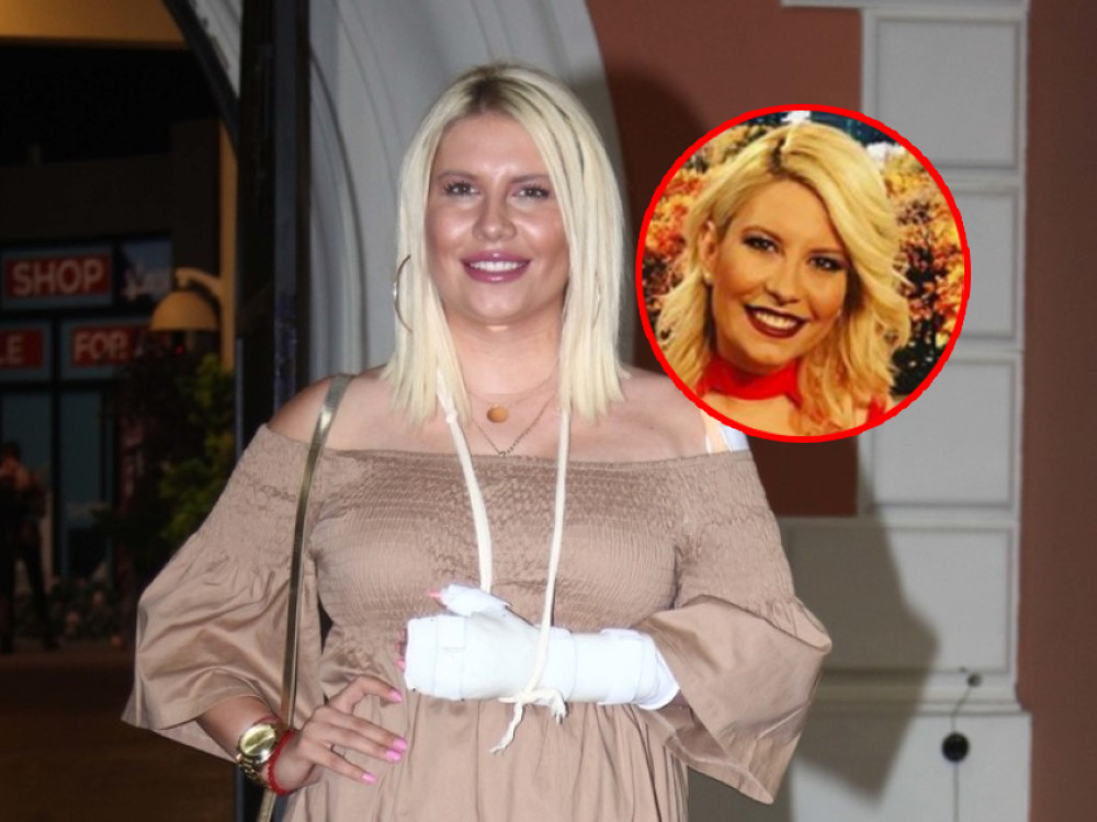 Dea Đurđević POVEĆALA USNE! Dok se oporavlja od stravične nesreće, uvek misli o lepoti (FOTO)