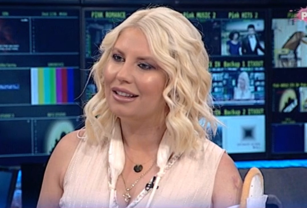 Prvi selfi POVREĐENOM rukom i DRASTIČNA promena! Dea Đurđević NEPREPOZNATLJIVA! (FOTO)