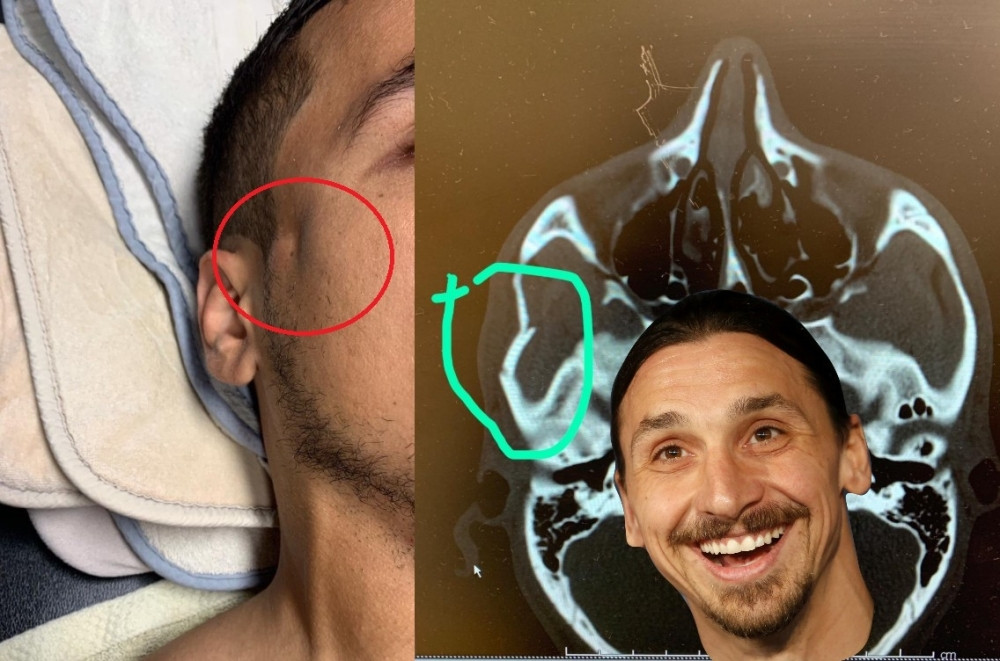 Ibrahimović ludačkim potezom slomio lobanju bivšem fudbaleru Partizana! (FOTO + VIDEO)