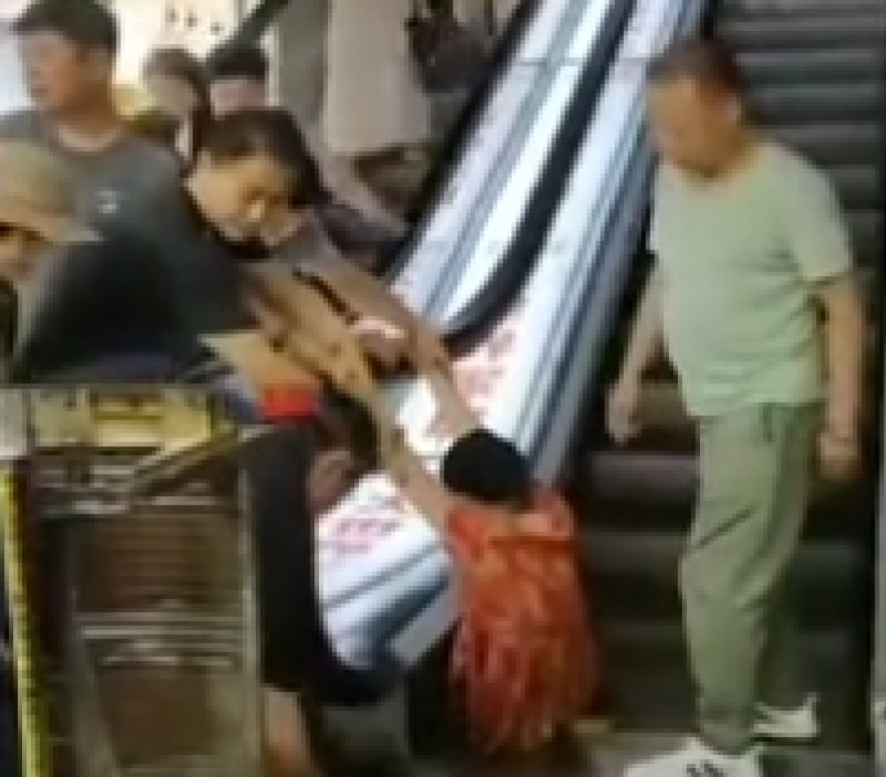 Žena propala kroz metal! Mehanizam joj otkinuo levu nogu do kolena, na desnoj teške povrede (FOTO)