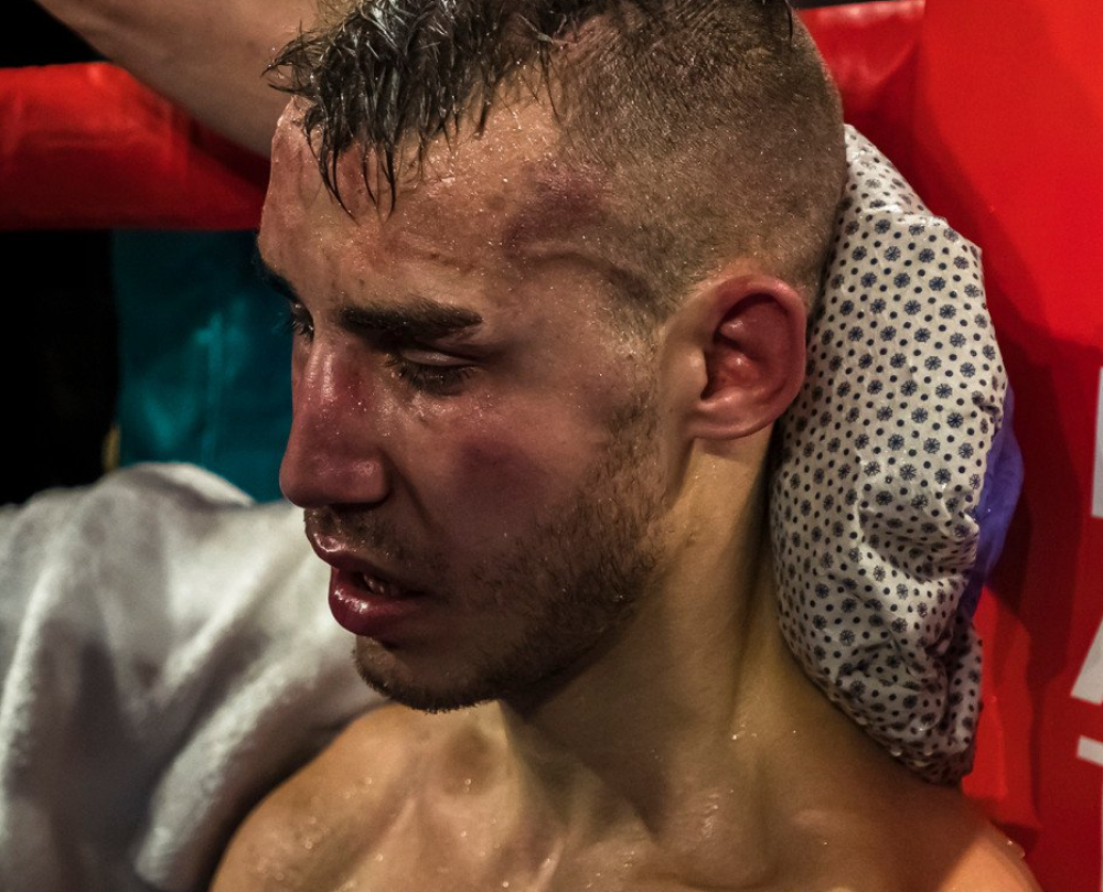 Ruski bokser dobio teške batine u ringu pa preminuo posle velike životne borbe! (VIDEO)