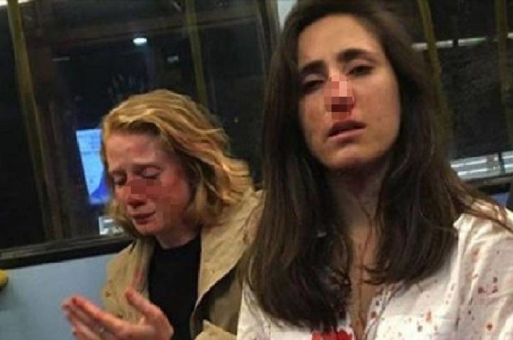 Vraćale se noćnim autobusom, jedva izvukle živu glavu! Pokušali da ih prisile na intiman čin, a onda je nastala ova fotografija (VIDEO)