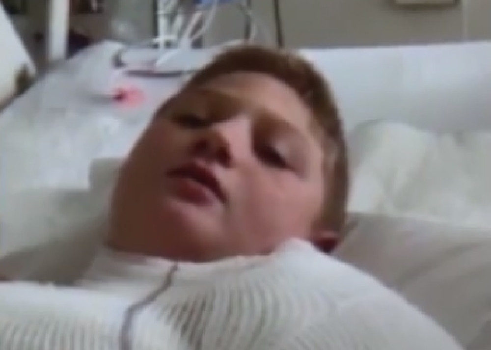 Spavao u tuđoj kući kada mu je drug spržio vrat i leđa! Zbog izazova koji kruži internetom jedna devojčica (8) je već umrla (FOTO)