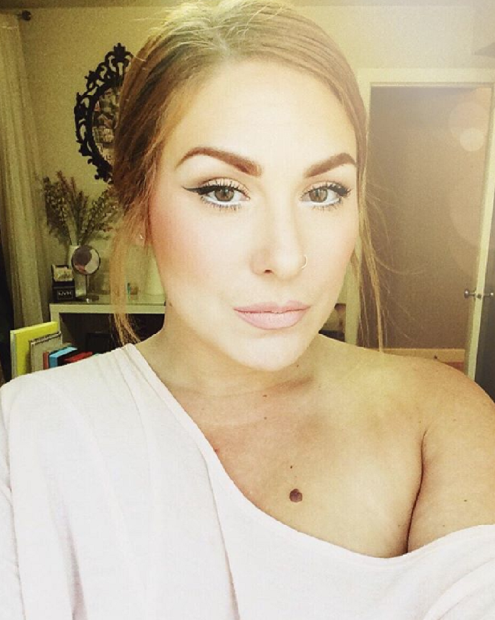 Zbog ovog voća koje je držala u rukama i otišla na plažu, nakon 2 dana probudila se u STRAVIČNIM OPEKOTINAMA!