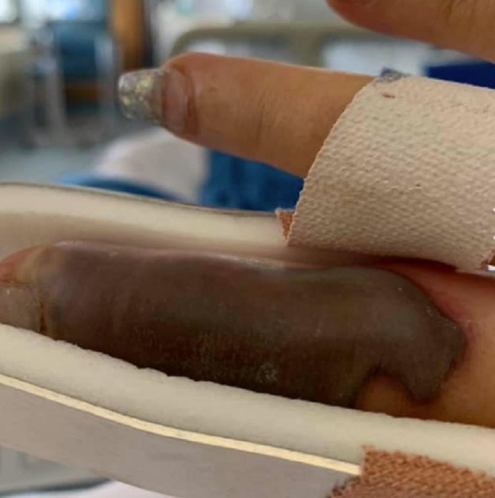 Otišla je da ulepša nokte, a sutradan nokat joj je bio potpuno CRN! (UZNEMIRUJUĆE FOTOGRAFIJE)