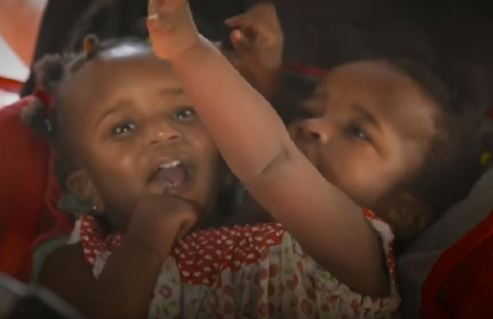 Otac sijamskih bliznakinja očajan: Ako se hirurški razdvoje, jedna ne bi preživela. Ako se ne razdvoje... Nemoguća odluka! (VIDEO)