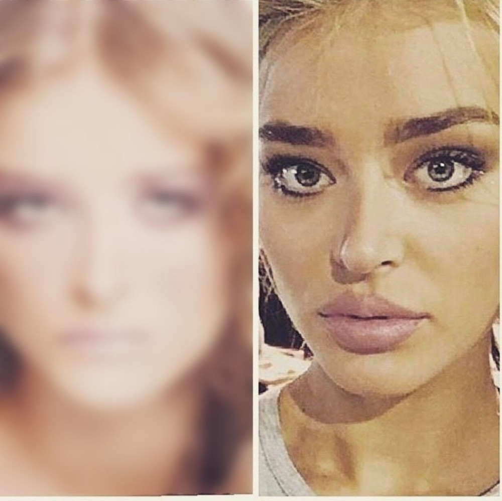 Pre plastičnih operacija Sofija Milošević je bila NEPREPOZNATLJIVA! Ovu sliku bi želela zauvek da izbriše! (FOTO)