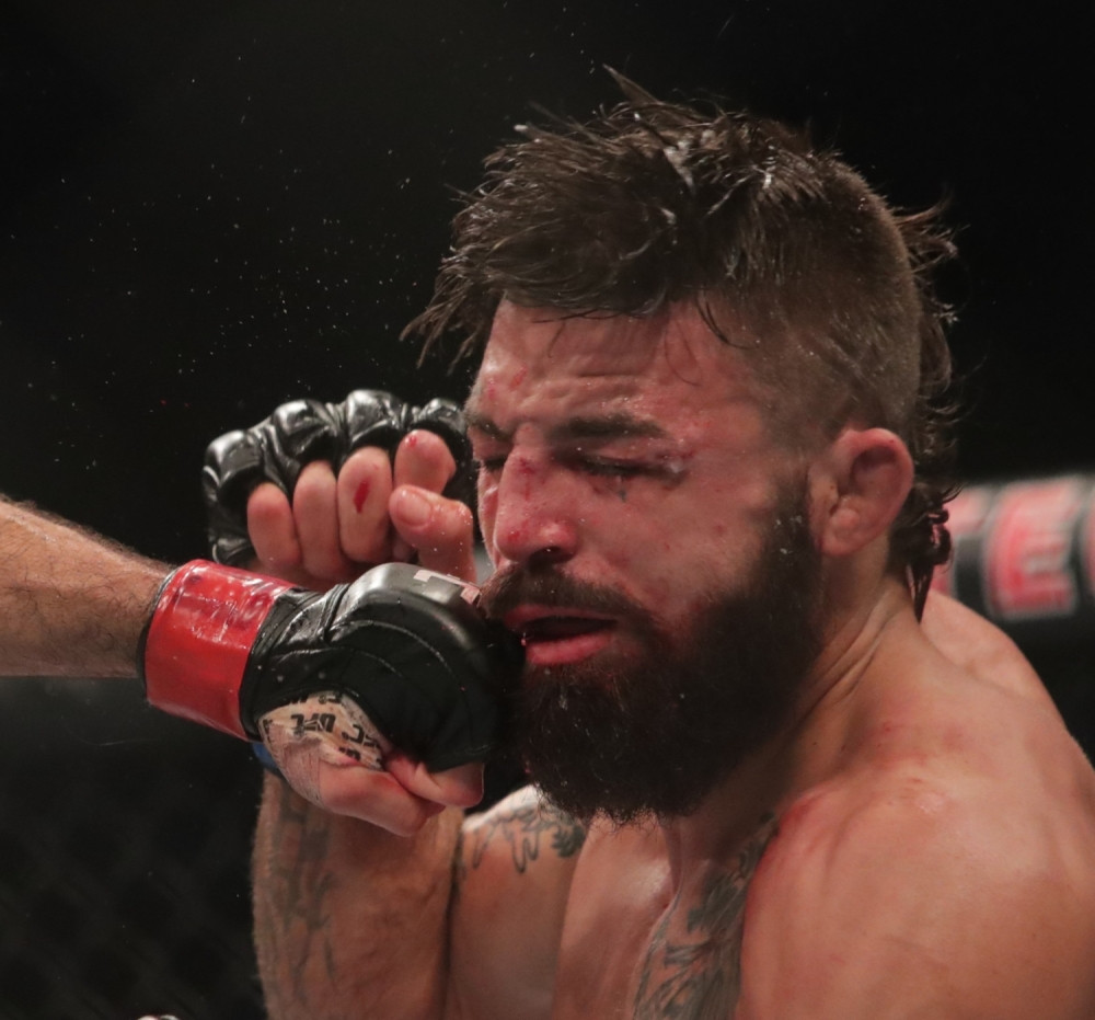 Kada pogledate njegov nos posle borbe proći će vam jeza, strašna transformacija borca! (FOTO 18+)