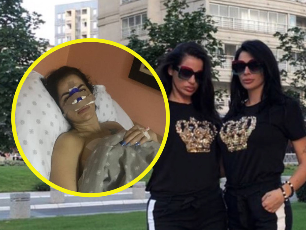 Dina i Šmizla iz "Parova" pokazale kako im izgleda lice nakon mučne operacije! (FOTO)