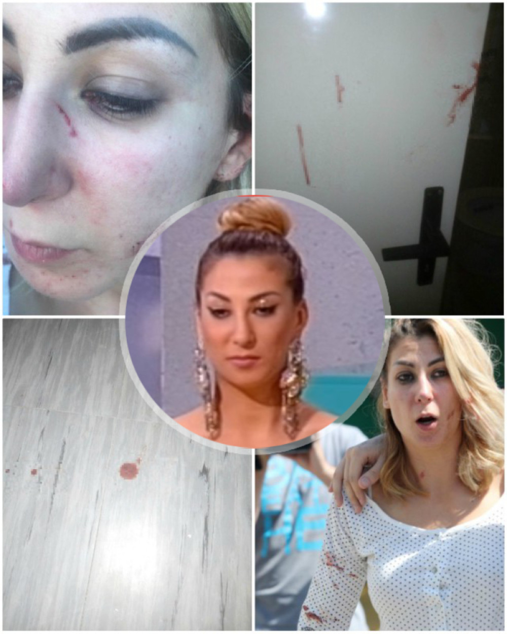 Najjezivije slike Tominog nasilja nad Nadeždom! Vrata izmazana krvlju, fleke po podu, pevačica potpuno deformisana! (FOTO 18+)