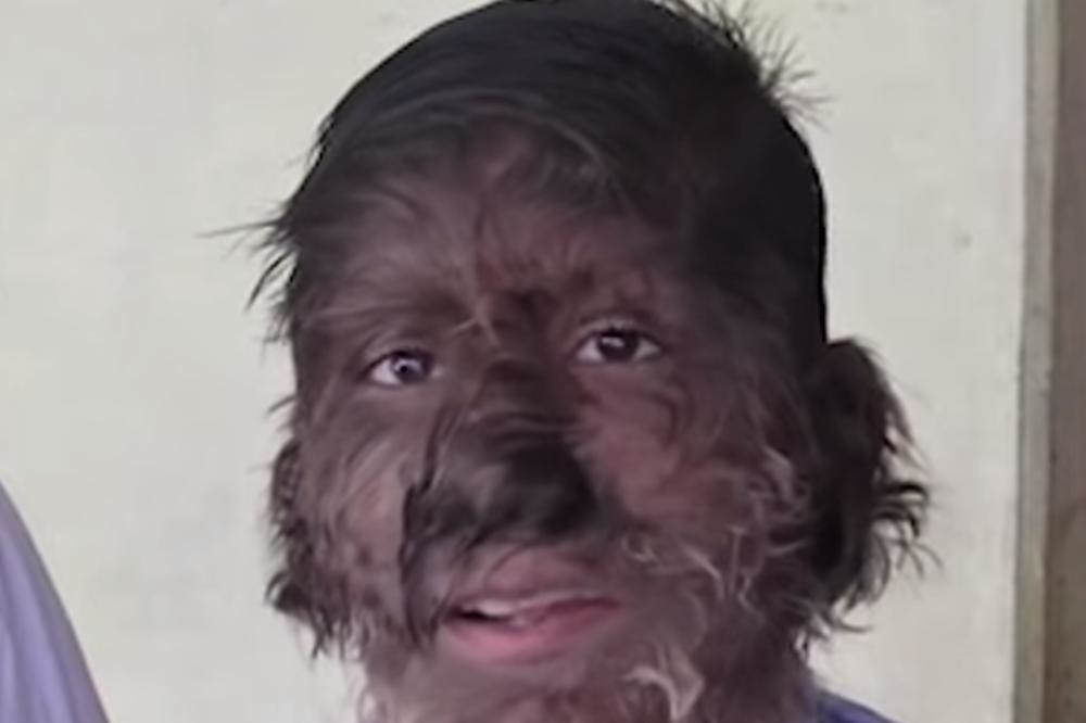 Roditelji primetili jezivu stvar, a onda je otkrivena monstruozna istina! (UZNEMIRUJUĆ VIDEO)