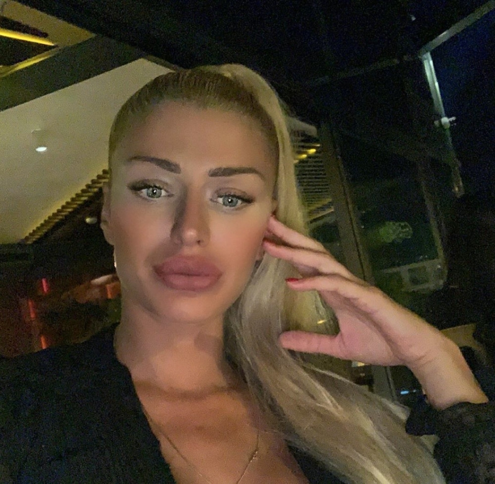 Manekenku Sandru Obradović pretukao suprug, zadao joj snažan udarac!