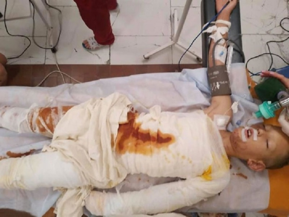 Dečaka (8) školski drugari polili benzinom i zapalili! Pao je na tlo i zapomagao, a onda su njegovi napadači načinili jeziv potez! (FOTO)