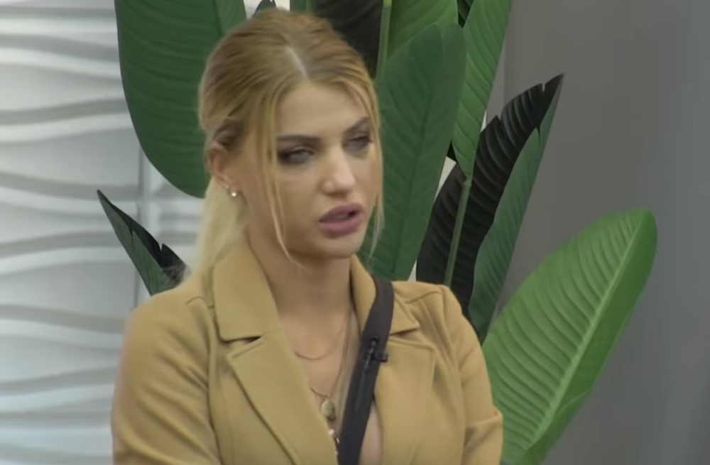 Milica Kemez skinula zavoje, pa pokazala kako izgleda: Novo LICE je skupo koštalo! (FOTO)