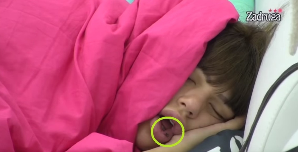 Fuj šta joj je to u ustima? Kamera zabeležila odvratne scene Miljane Kulić dok spava!