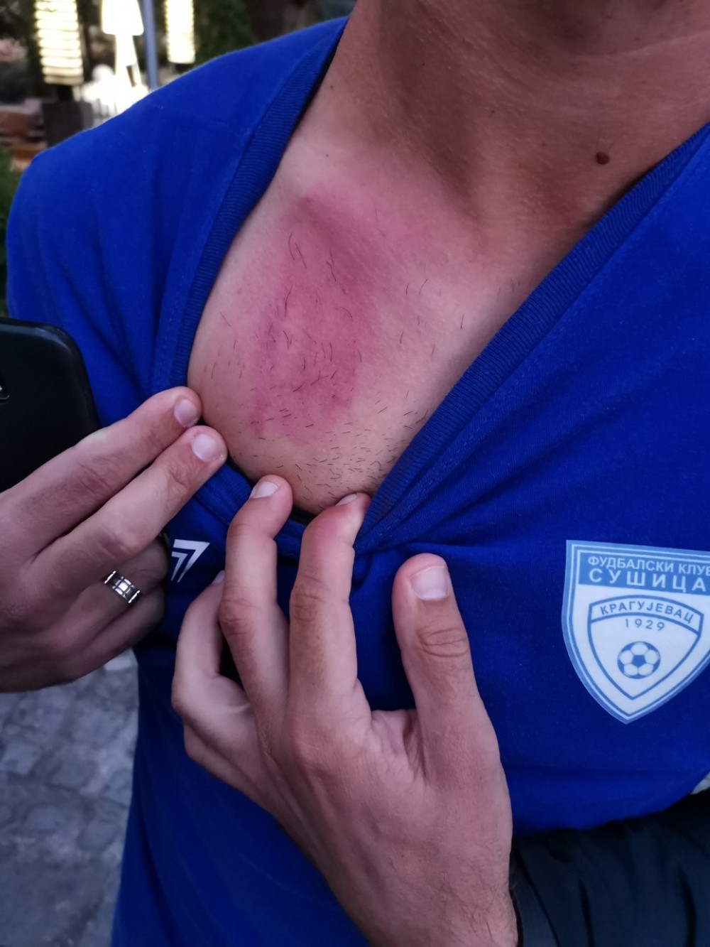 Srpskoligaš iz Kragujevca tvrdi da su ih huligani u Valjevu gađali BICIKLAMA I FLAŠAMA! (FOTO)