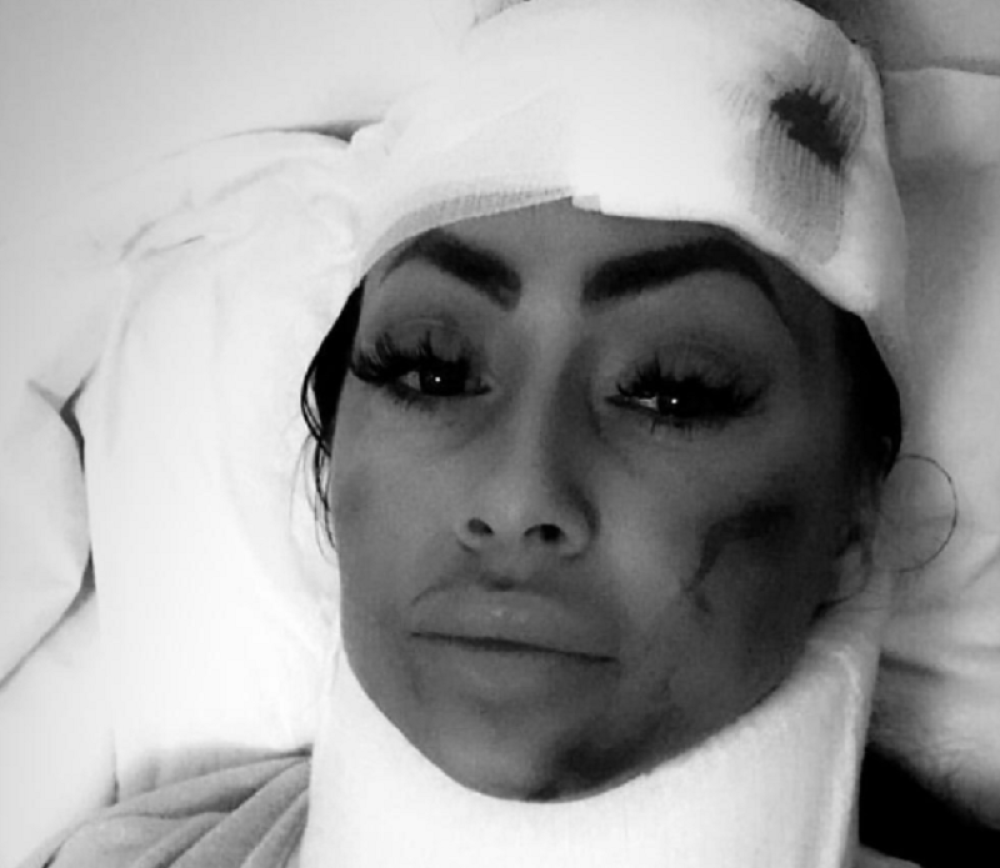 Zvezda Granda i bivša devojka Darka Lazića završila u bolnici! Zadobila stravične povrede! (FOTO)