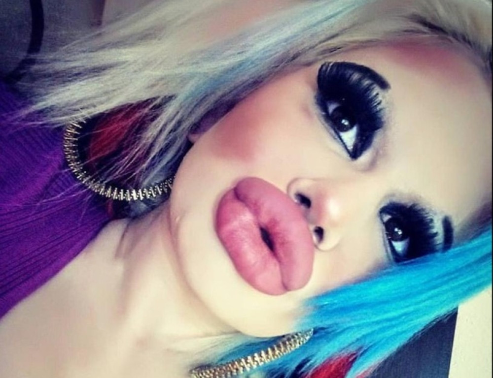 Andrea ima najveća usta na svetu! Planira da ih još napumpa, a kada čujete zašto to radi, ostaćete u čudu!