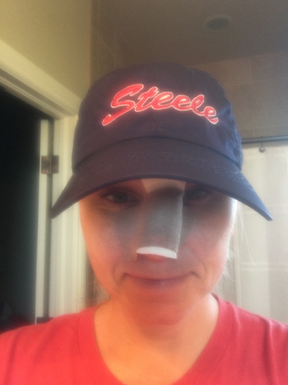 Otišla kod lekara zbog fleke na licu, a saznala je zastrašujuću vest! Ostala bez pola nosa, preživela horor zbog greške koju mnogi prave!