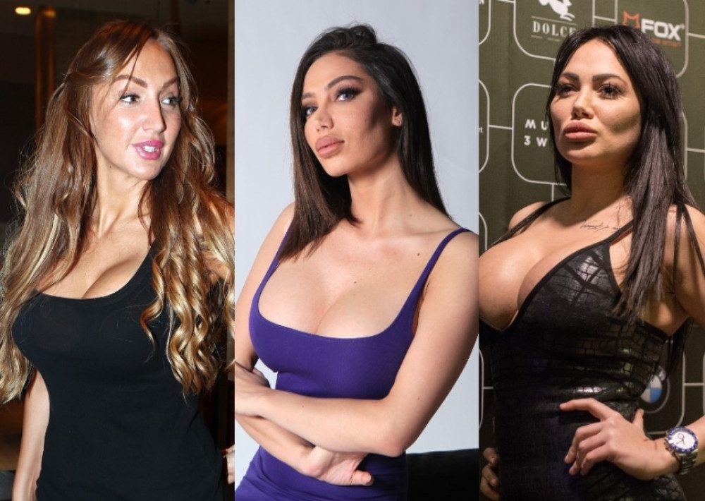 Ove estradne zvezde su preterale sa zahvatima! (FOTO)