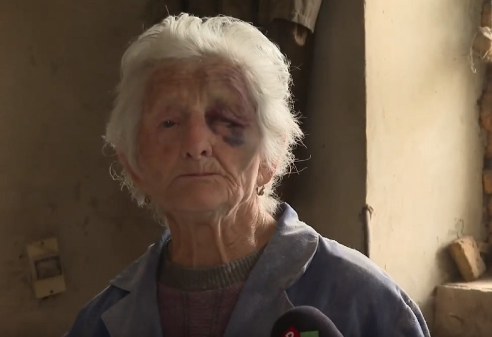 Ovo je baka (88) koju su lopovi krvnički pretukli, sva modra i isprepadana (VIDEO)
