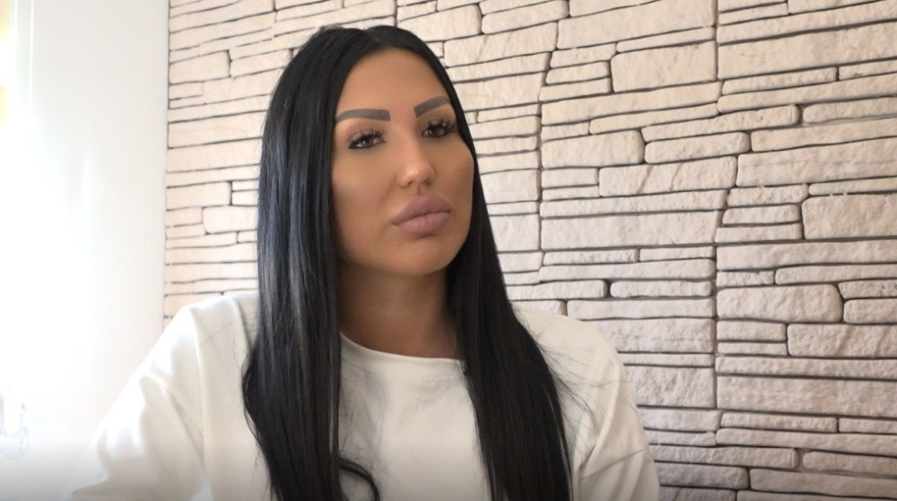 Isplivale fotografije pre estetskih operacija: Tijana Ajfon ne liči na sebe bez silikona! (FOTO)