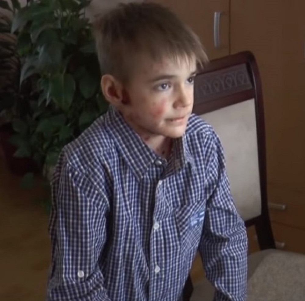 Preminuo dečak leptir iz Bajine Bašte! Danima bio bez svesti